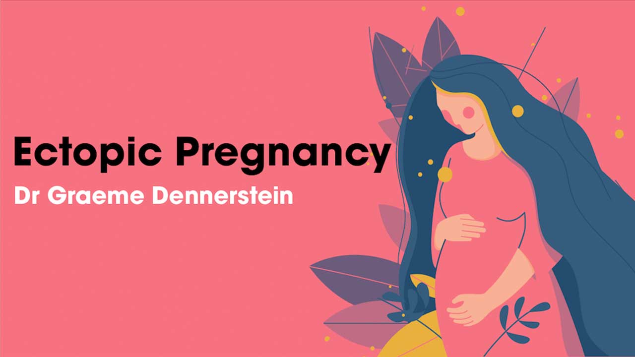 Cover image for: Ectopic Pregnancy